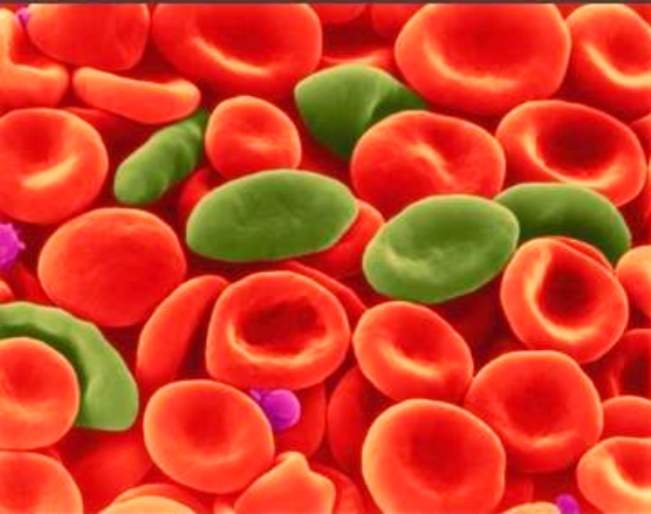 Советы Аюрведы: лечение анемии